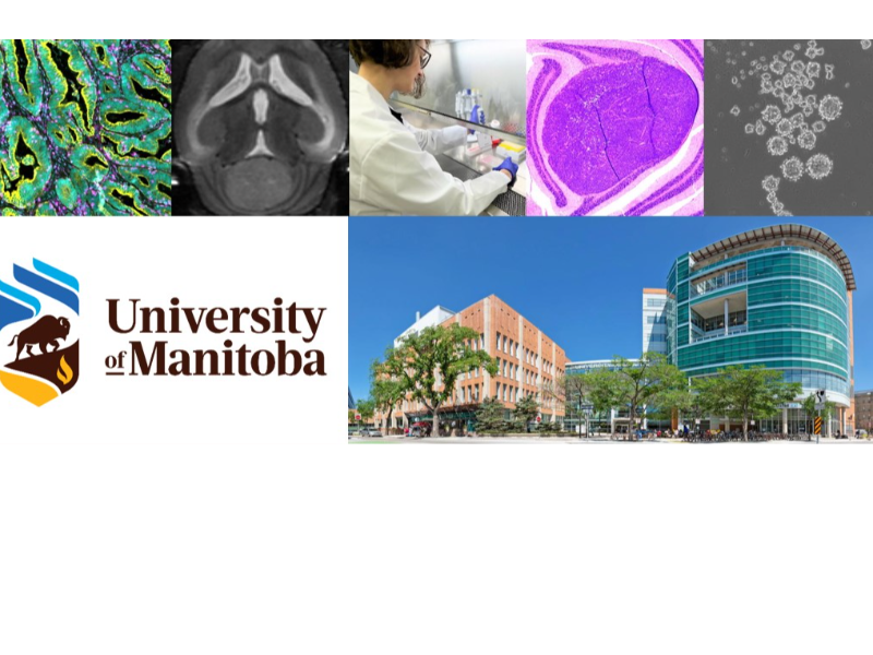 Graduate Student Positions Available in Adult and Pediatric Brain Cancer Research